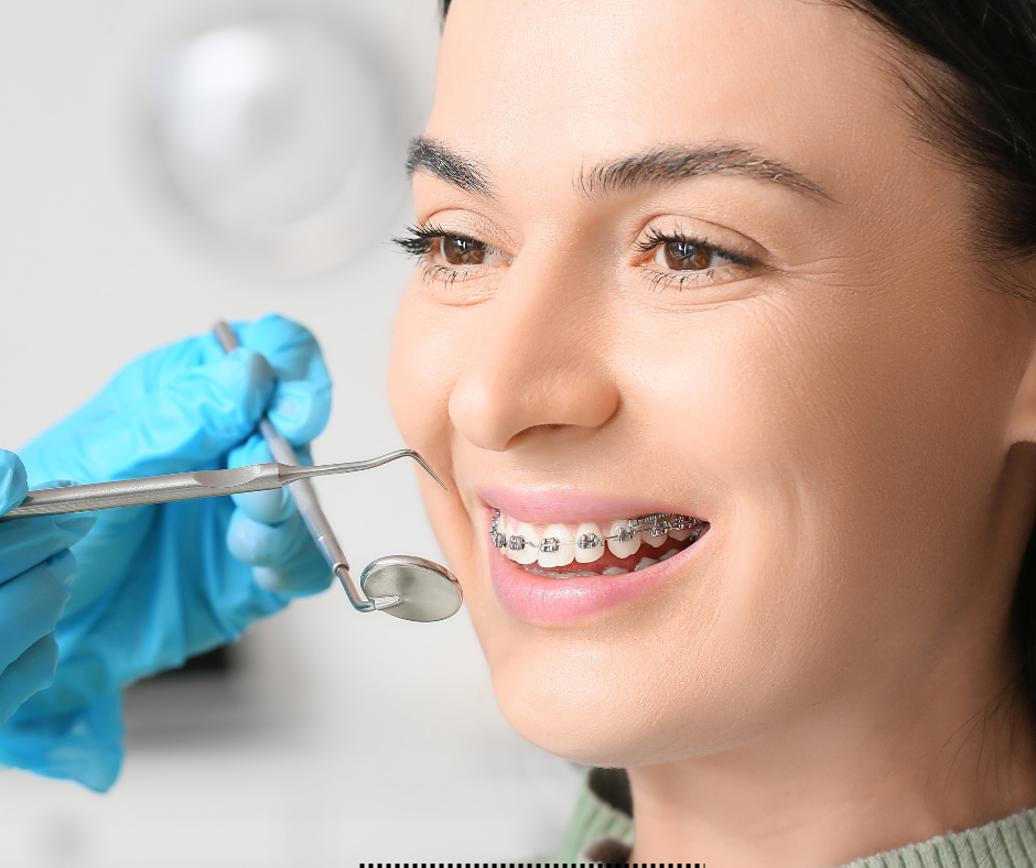 cosmetic treatments after orthodontics