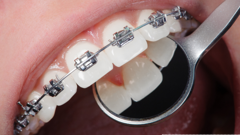 orthodontics